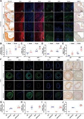 Syndecan-1 as a predictor of vulnerable atherosclerotic plaques